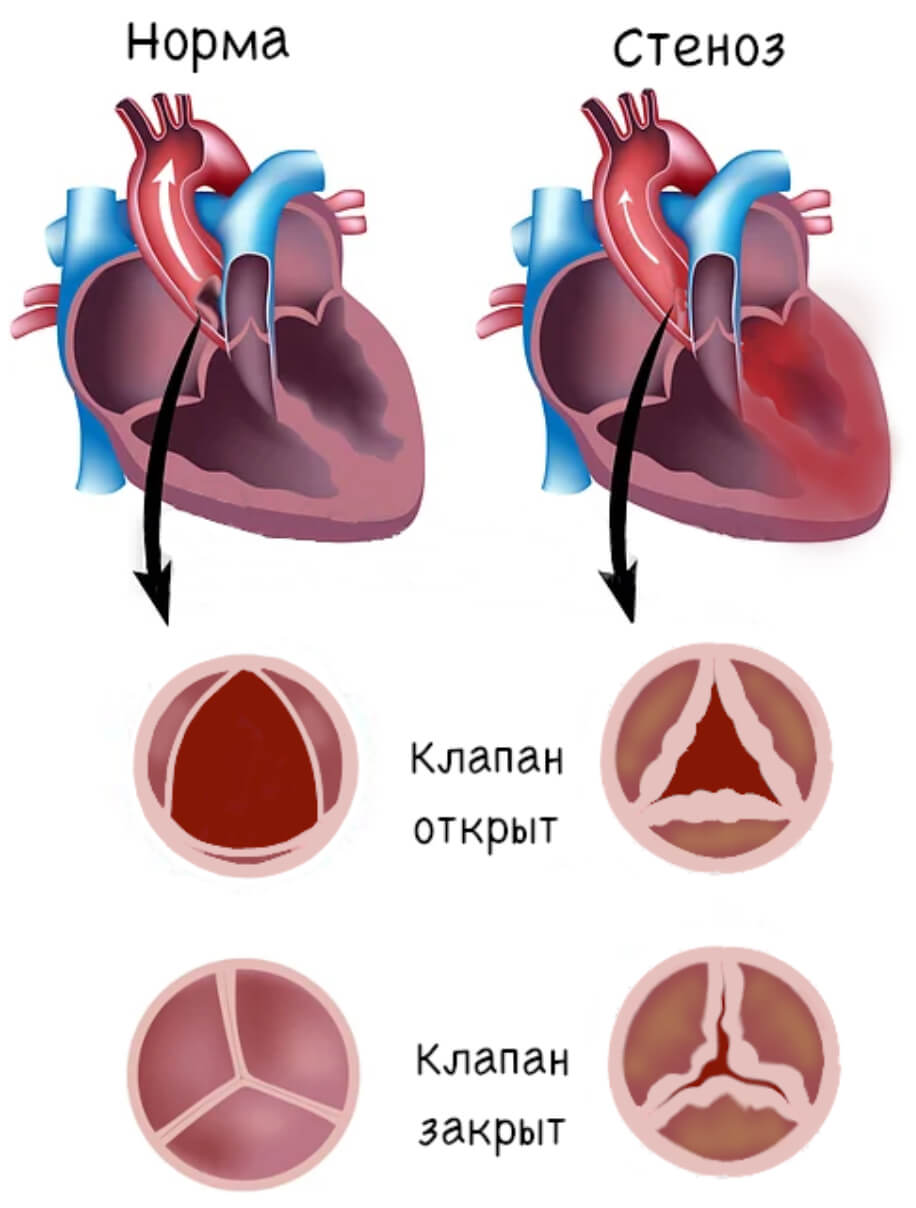 Сердце б